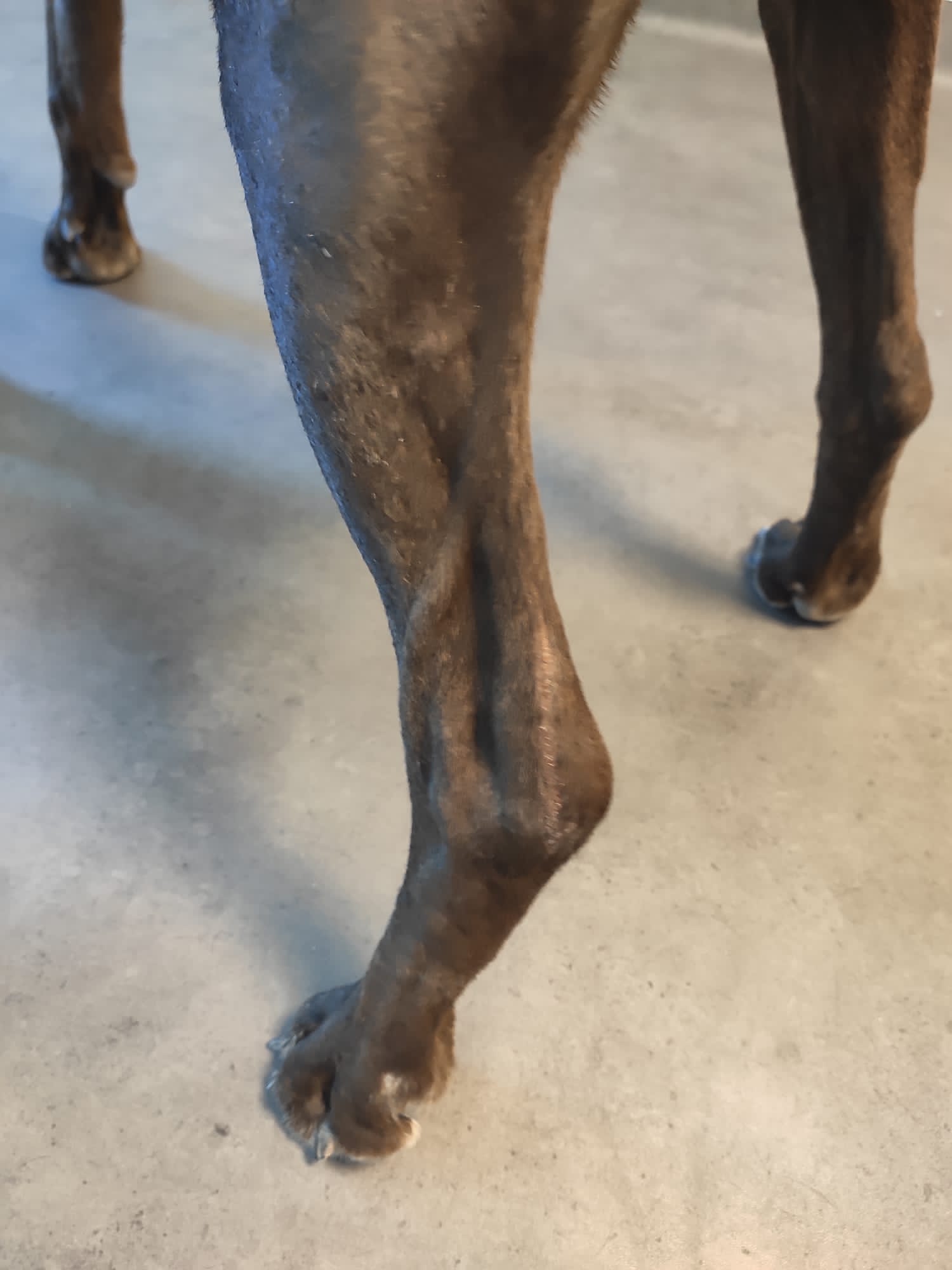 Suivi à 2 mois d’une rupture complète du tendon d’Achille avec appui normal sans plantigradie