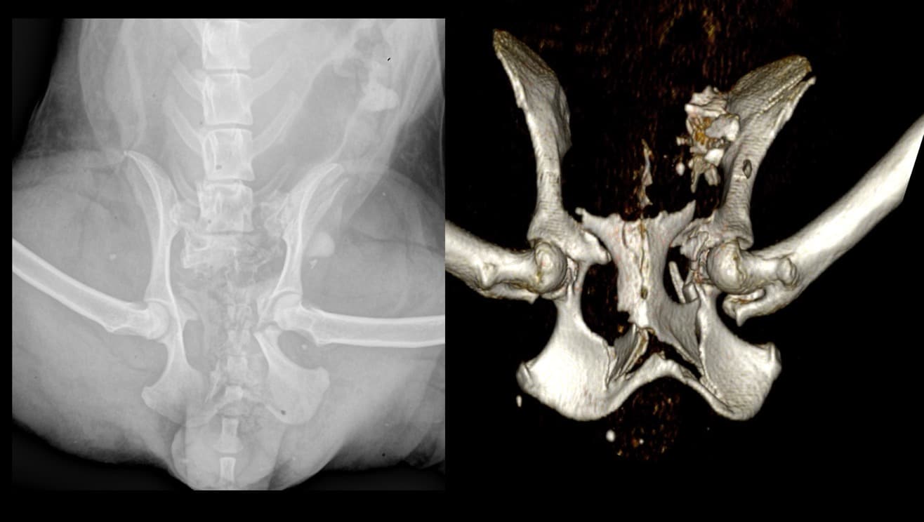 Fractures du bassin chez le chien avec radiographie montrant une fracture-luxation sacro-iliaque bilatérale, une fracture d’acétabulum et des fracture du pubis. Scanner du même chien mettant en avant les très nombreuses fractures du pubis.