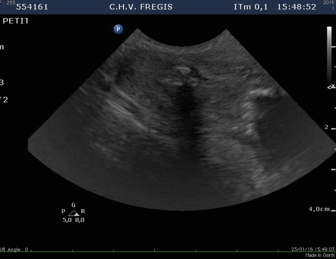 Echographie d’un chien de race Doberman présentant une lésion du tendon d’Achille (corde du jarret).