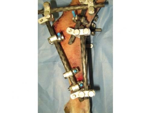 Chirurgie d’une rupture du tendon d’Achille (corde du jarret) chez le chien et mise en place d’un fixateur externe comme soutien après reconstruction tendineuse.