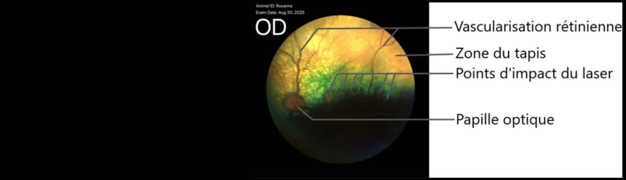 Geste technique du mois : Ophtalmologie