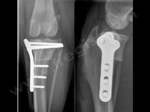 Radiographies d’un genou de chien en post-opératoire d’une TPLO. A gauche : vue de face. A droite : vue de profil. 
