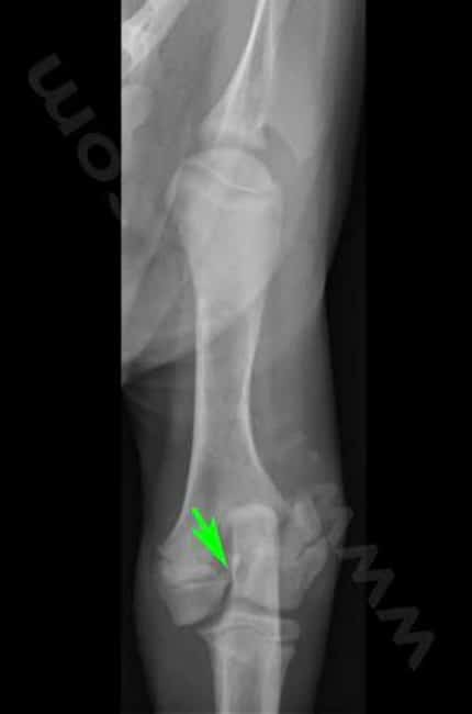 Radiographie de l’humérus d’un chiot avec une fracture de la plaque de croissance