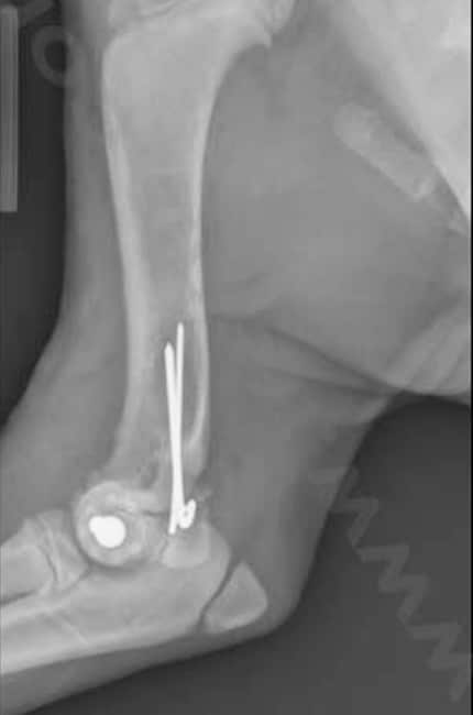 Vue post-opératoire montrant une bonne réduction, avec une stabilisation optimale