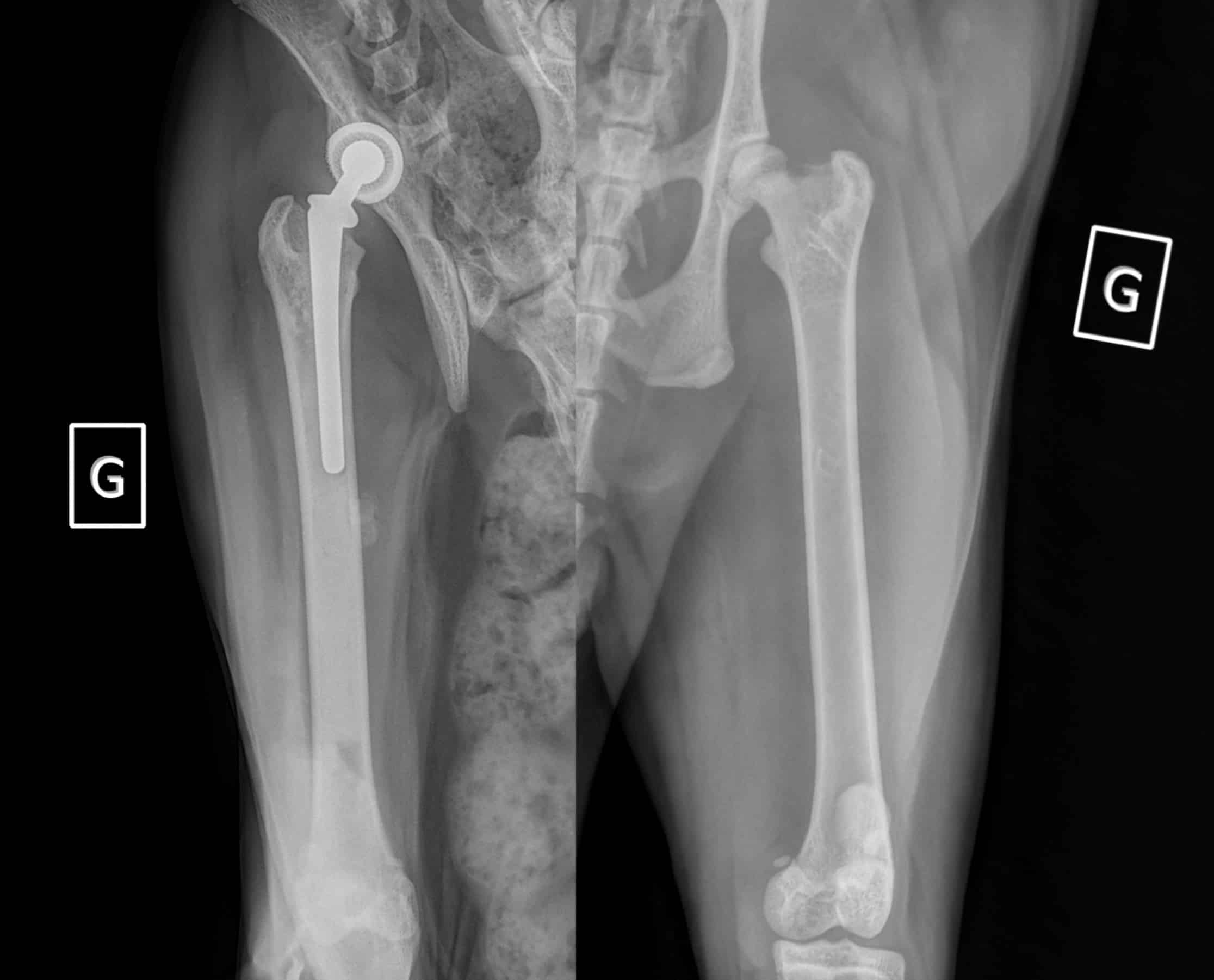 Radiographies de hanches atteintes de glissement epiphysaire, maladie assez spécifique du chat qui bénéficie d’une prothèse de hanche.