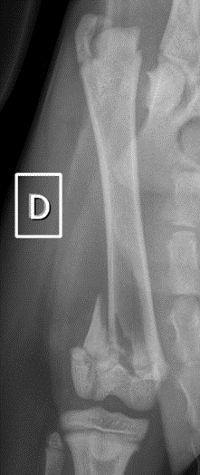 Radiographie du fémur d’un chaton avec une fracture de la plaque de croissance en zone proximale et en zone distale.