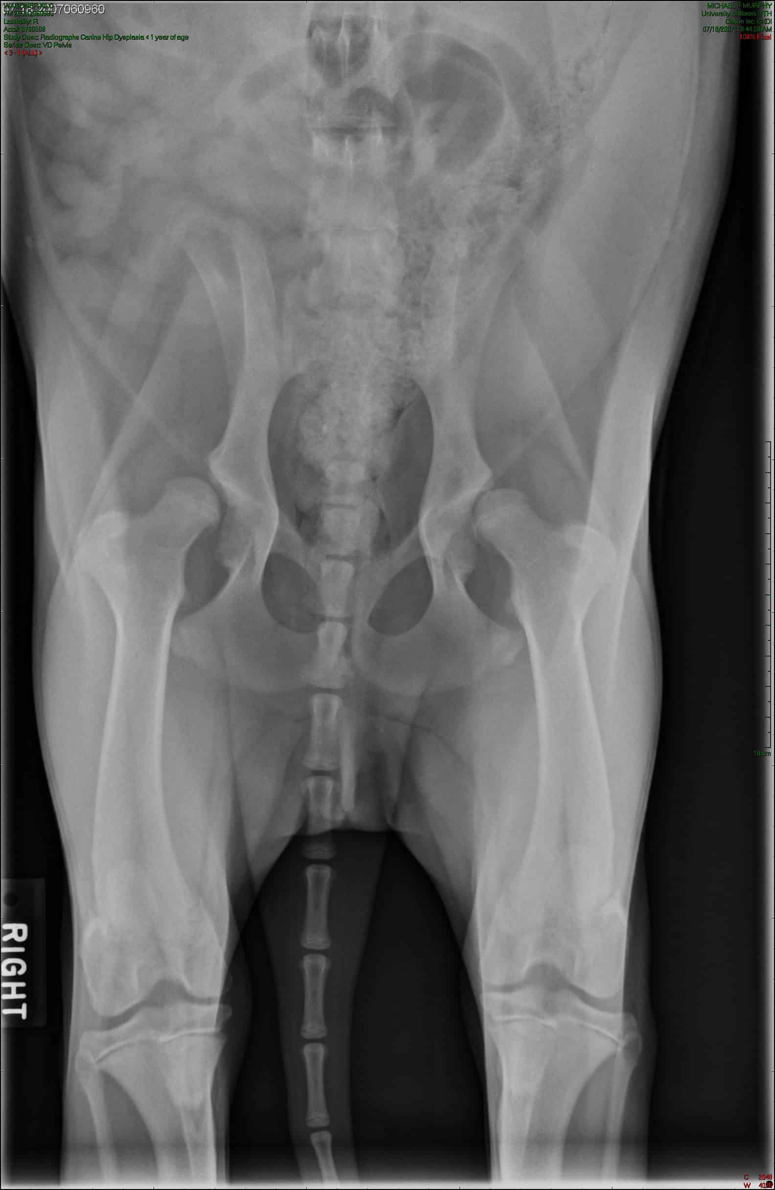 Radiographie des hanches d'un chien adulte, totalement remodelées par de l'arthrose ce qui leur donne un aspect en champignon