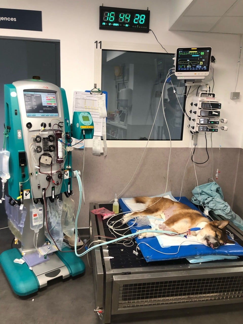 Patient en IRA pendant une séance d’hémodialyse.