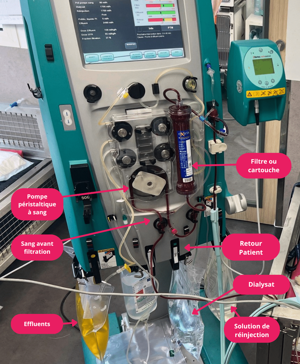 Dispositif de dialyse.