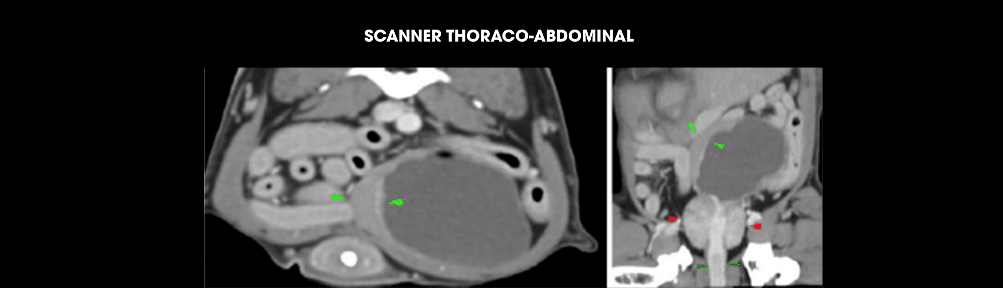 Cas cliniques : Oncologie