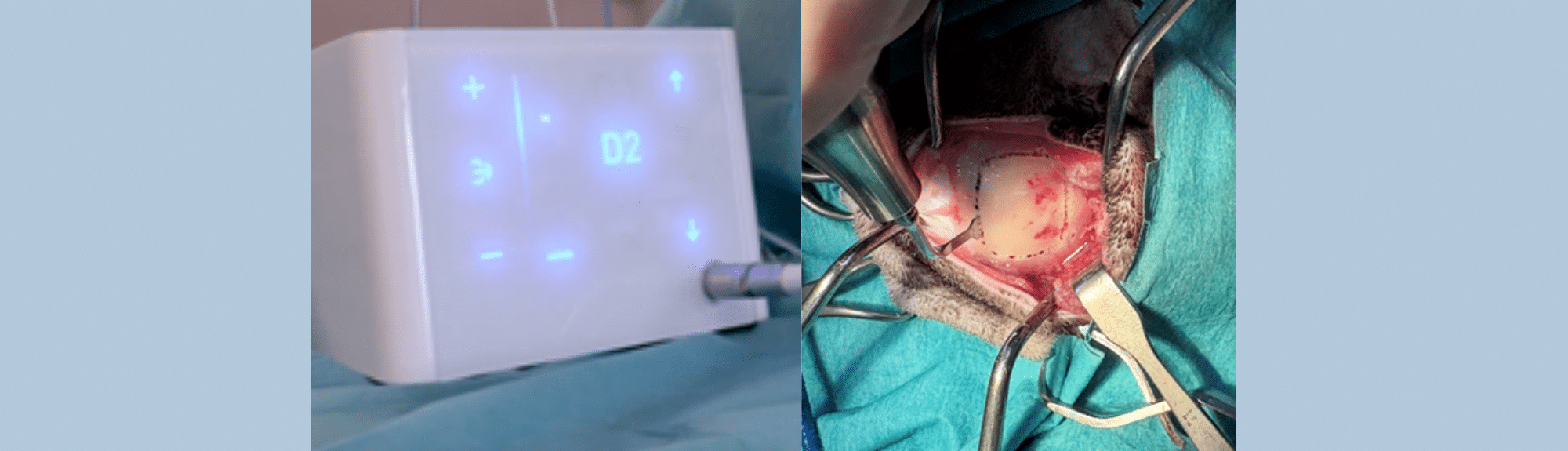 Geste technique du mois : Neurologie