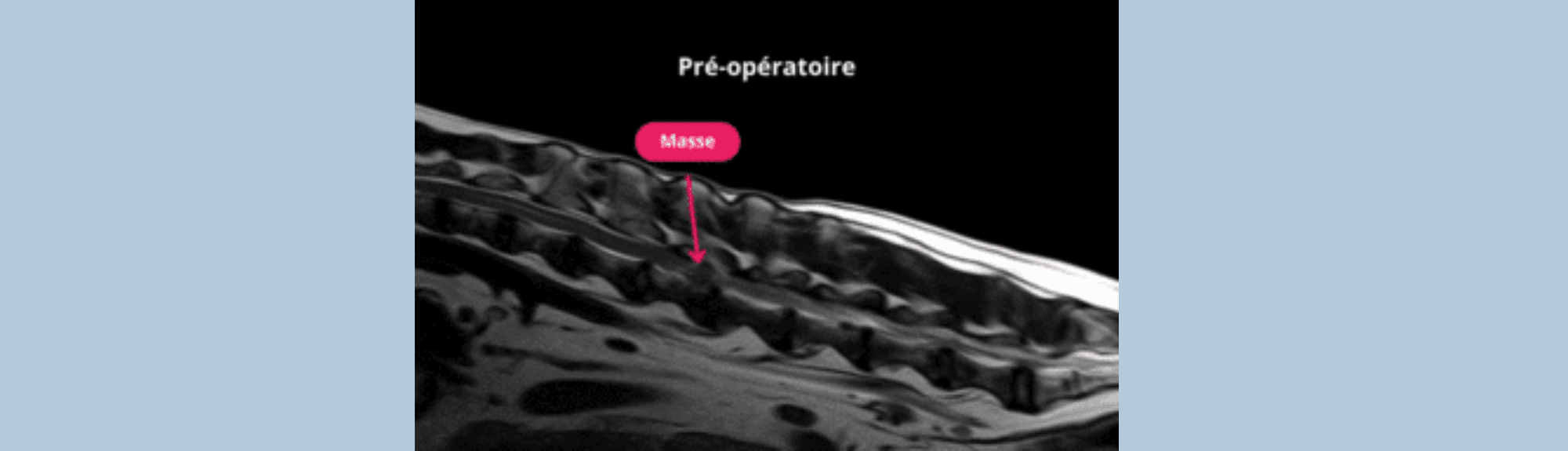 Cas cliniques : Neurologie